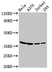 L-lactate dehydrogenase A chain antibody