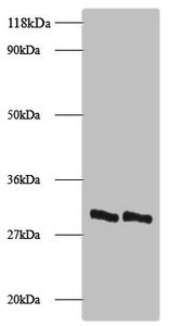 L-lactate dehydrogenase A chain antibody