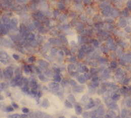 L-Plastin antibody