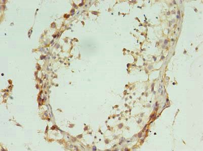 L2HGDH Antibody