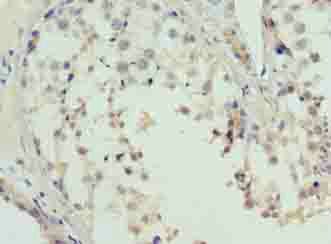 L3MBTL4 Antibody