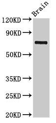 L3MBTL4 antibody
