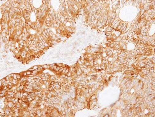 Ladinin 1 antibody [C1C3]