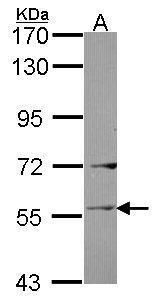Ladinin 1 antibody