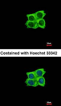 Ladinin 1 antibody