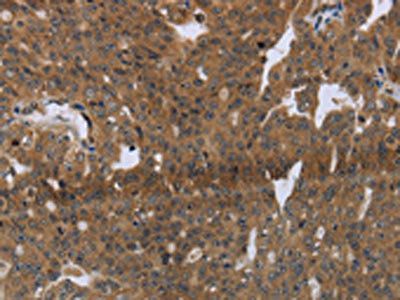 LAIR2 Antibody