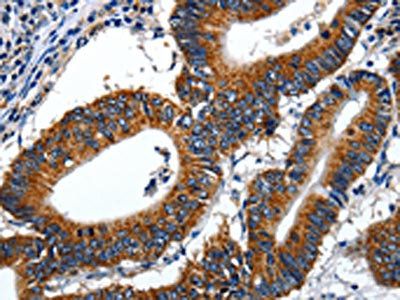 LAMA1 Antibody