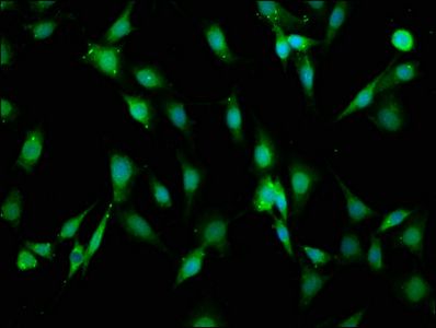 LAMA2 Antibody