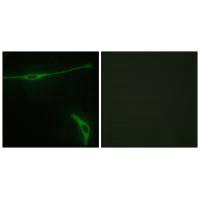 LAMA2 Antibody