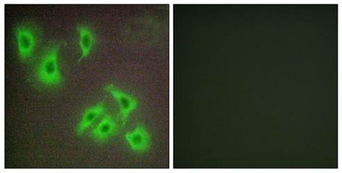 LAMA3 antibody