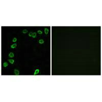 LAMA4 Antibody
