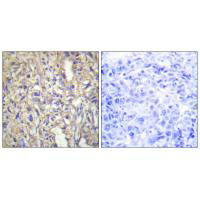 LAMB1 antibody