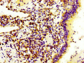 LAMB3 Antibody