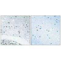 LAMC3 Antibody