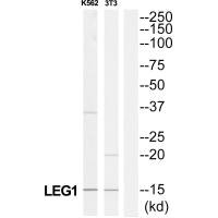 LAMC3 antibody