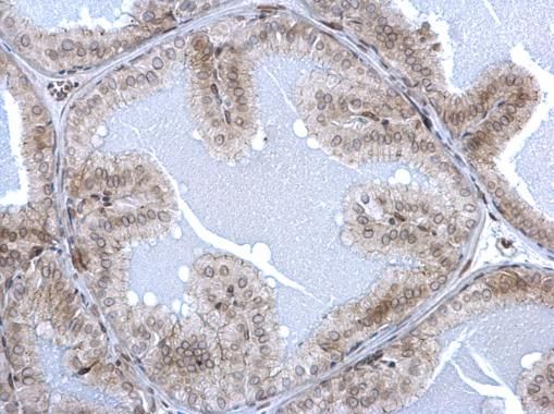 Lamin A + C antibody