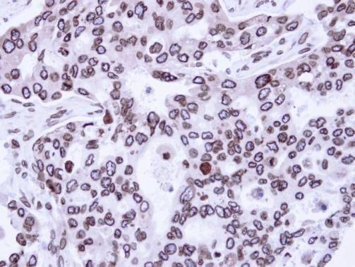 Lamin A + C antibody