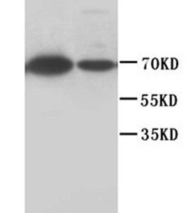 Anti-Lamin B1/LMNB1 Antibody