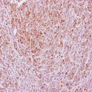 Laminin gamma-2 antibody
