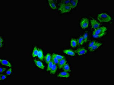 LAMP2 antibody