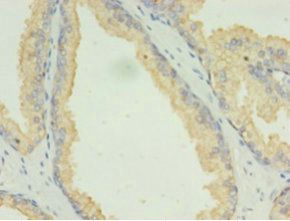 LAMP2 Antibody