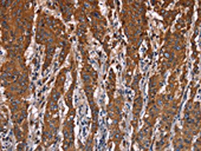LAMP2 Antibody