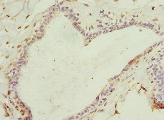 LAMTOR5 Antibody