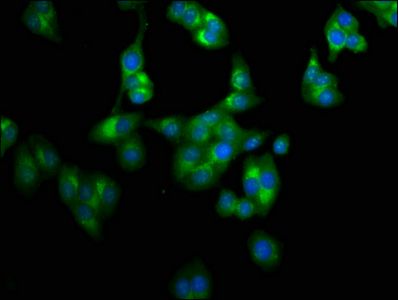 LAPTM4A Antibody
