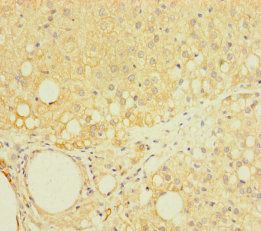 LAPTM5 Antibody