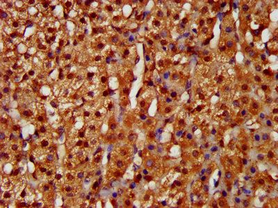 LARP6 Antibody