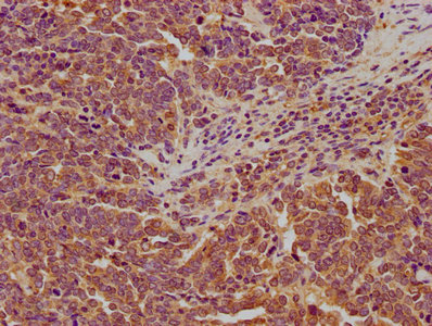 LARS Antibody