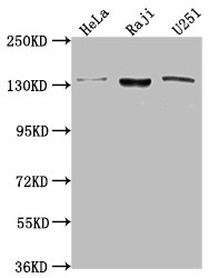 LARS antibody