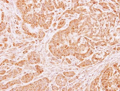 LARS2 antibody [N2C1], Internal