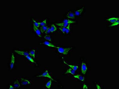 LASP1 Antibody
