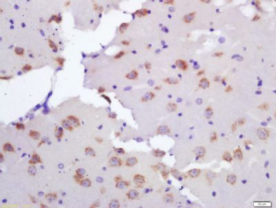 Ceramide synthase 2 Rabbit Polyclonal Antibody