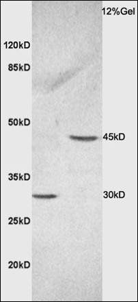 Ceramide synthase 2 Rabbit Polyclonal Antibody