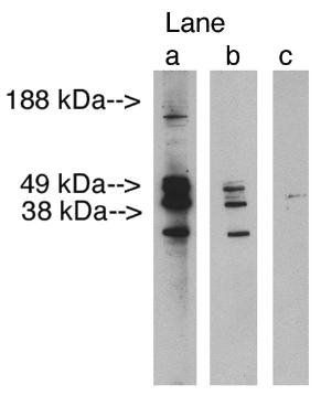 Rabbit anti Human Lass3 Antibody