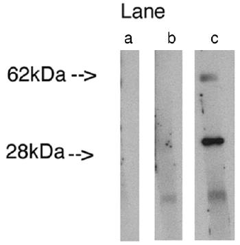Rabbit Human Lass4 Antibody