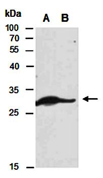 LAT (C2) Antibody, Rabbit Polyclonal