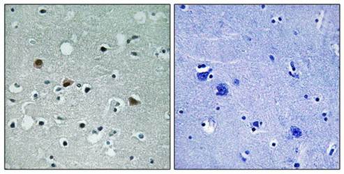LATS1/2 (Phospho-Thr1079/1041) Antibody