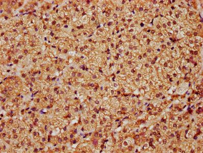 LATS1 Antibody