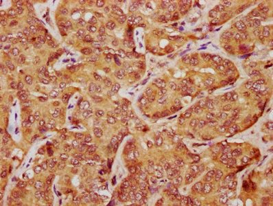 LATS1 Antibody