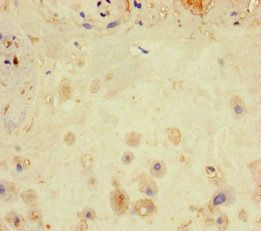 LATS1 Antibody