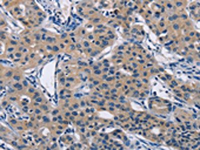 LATS1 Antibody