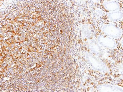 LBP Rabbit Polyclonal Antibody