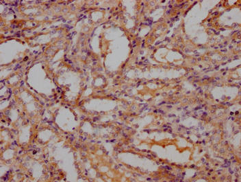 Lbp Antibody