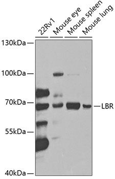 LBR antibody