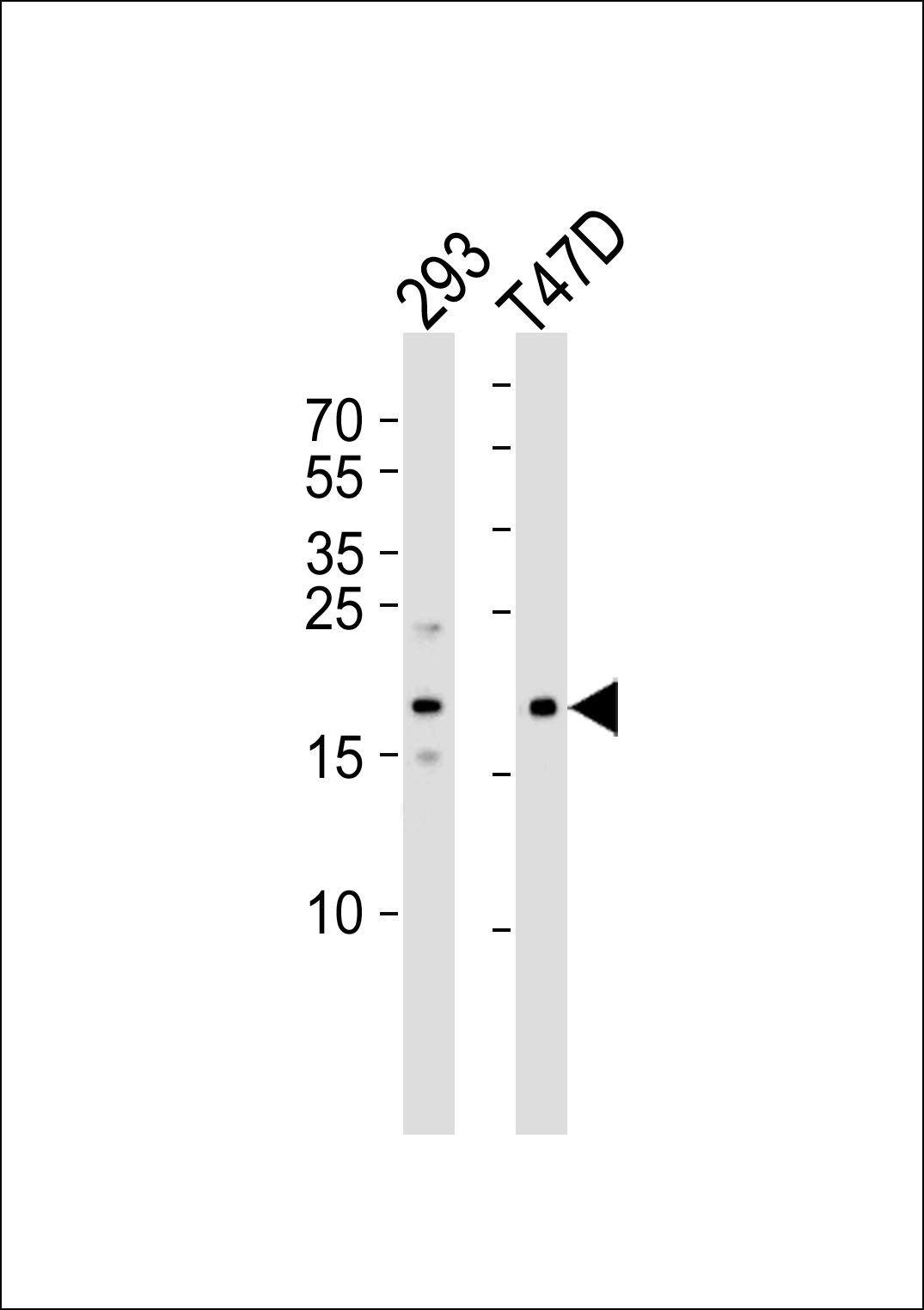LC3 antibody