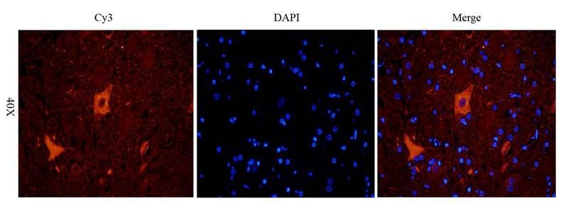 LC3 antibody