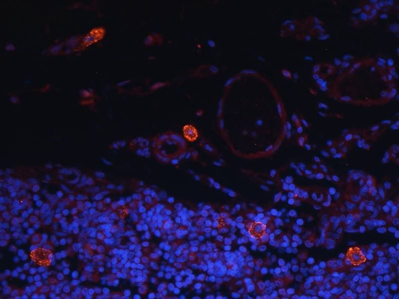 LC3 antibody